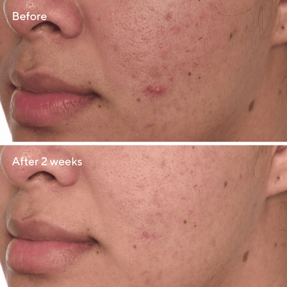 Murad Rapid Dark Spot Correcting Serum (30ml)
