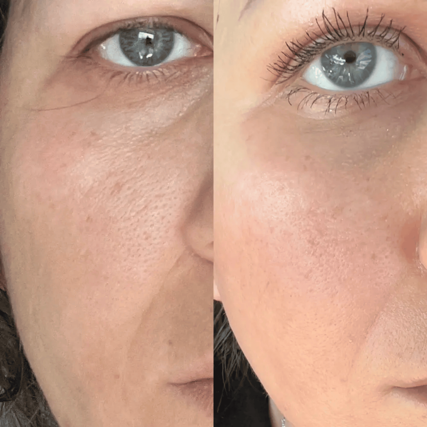 Medicube Zero Pore Cream 2.0