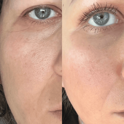Medicube Zero Pore Cream 2.0