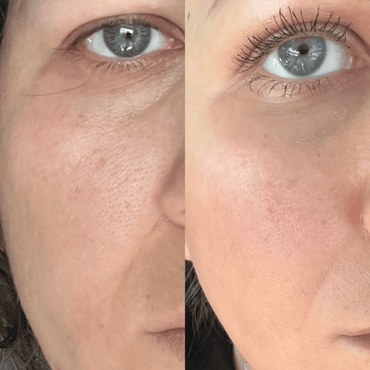 Medicube Zero Pore Cream 2.0