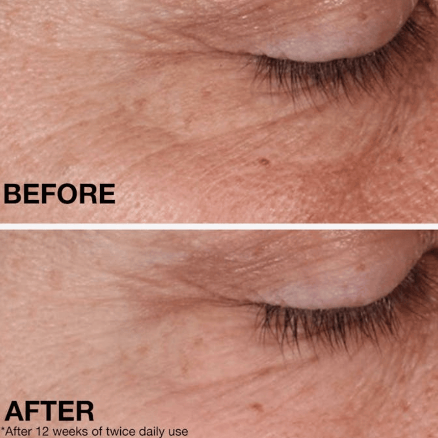 Neutrogena Retinol Regenerating Cream (48g)