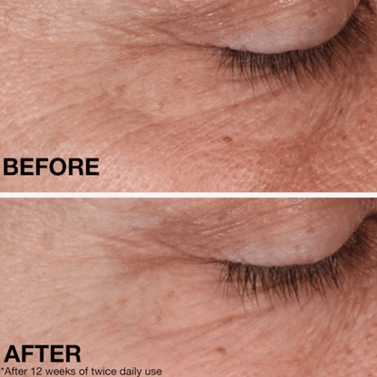 Neutrogena Retinol Regenerating Cream (48g)