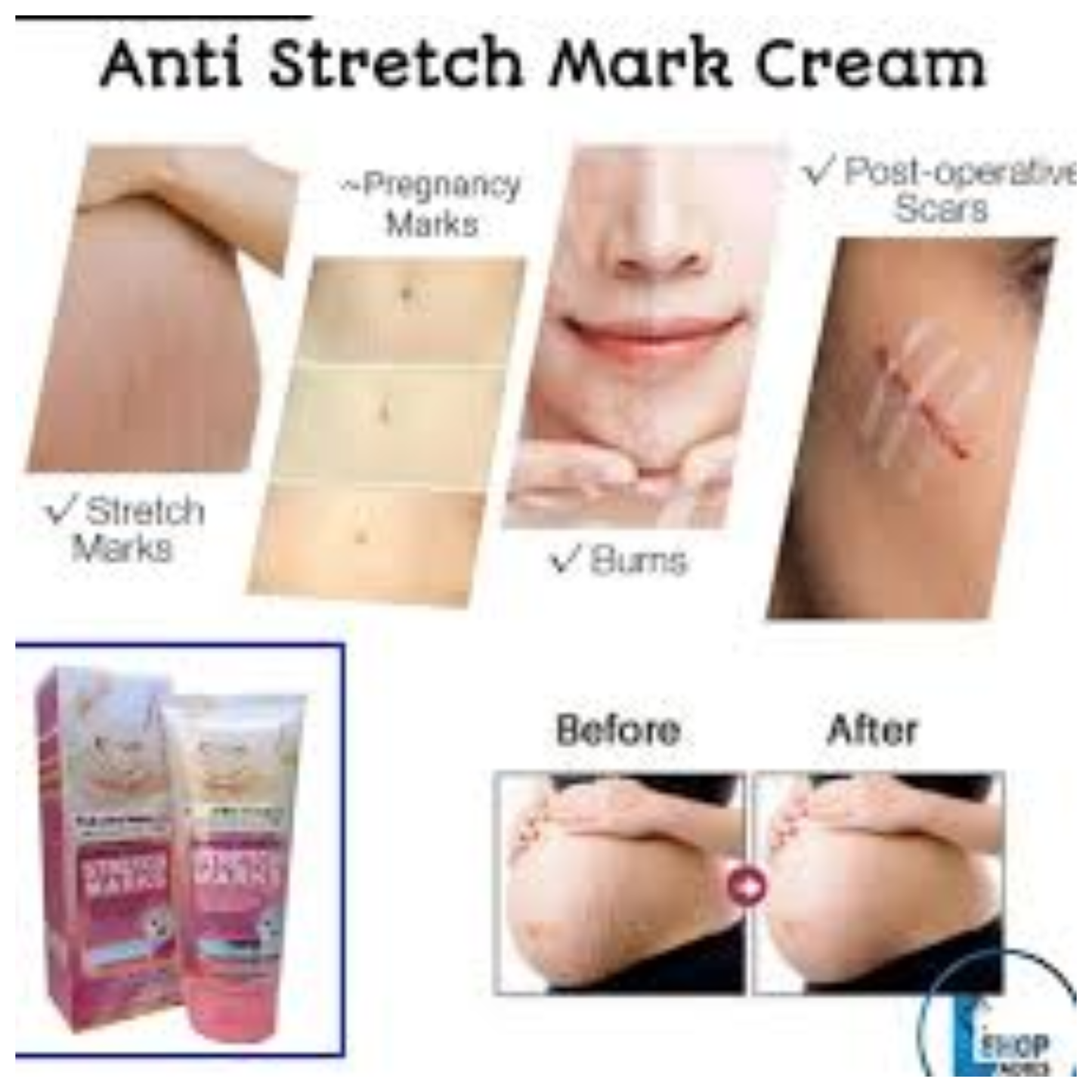 Original
  Fruit Of The Wokali Stretch Mark Cream 