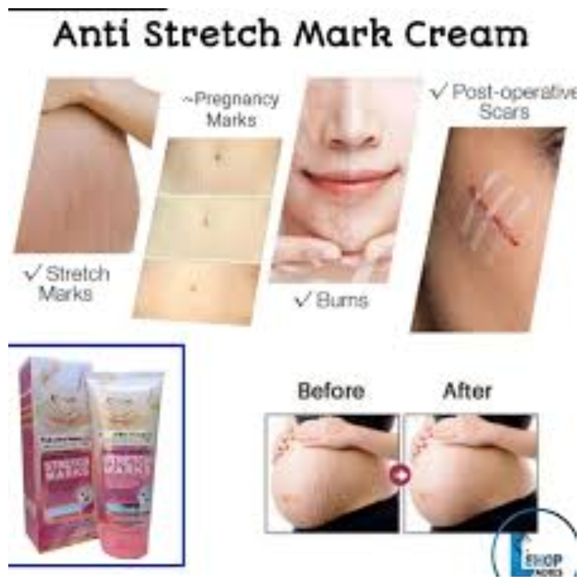 Original
  Fruit Of The Wokali Stretch Mark Cream 